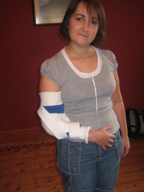 Tracy wearing the bent splint