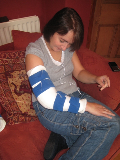 Tracy wearing the straight splint