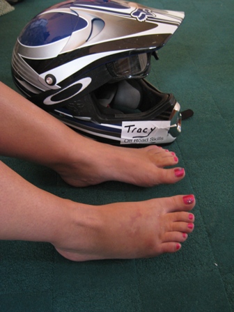 Tracy’s broken and swollen foot…